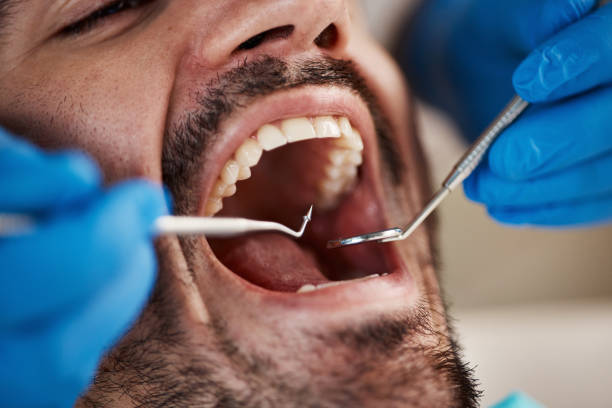 Best Emergency Gum Treatment in San Joaquin, CA